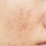 Minimizes Dark Spots Sweet Almond Oil Coffee Scrub